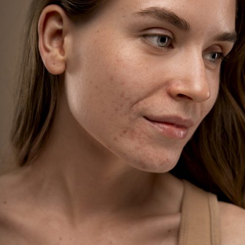 portrait-person-with-dermatitis-skin-condition