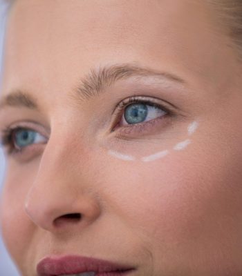 Close-up of woman with marks drawn for cosmetic treatment