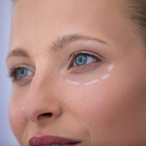 Close-up of woman with marks drawn for cosmetic treatment